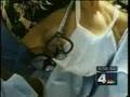 NBC4 News - Georgetown's 500th Liver Transplant