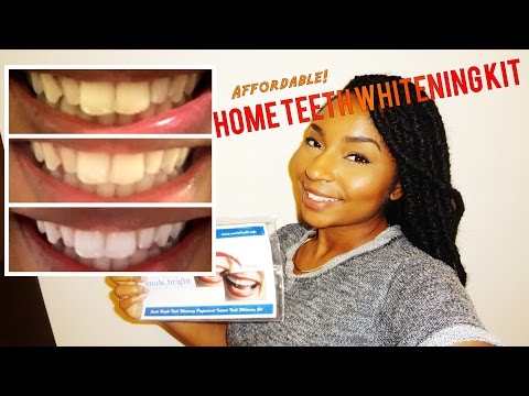 how to whiten super yellow teeth
