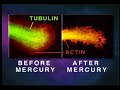 How mercury causes brain neuron degeneration