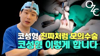 앤플러스 성형외과_코성형