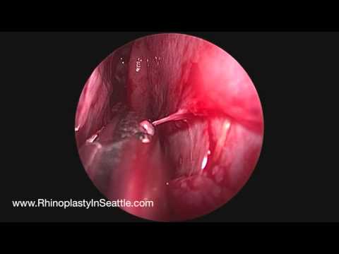 how to open up sinuses