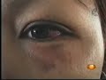 VIOLENCIA INTRAFAMILIAR VIOLENCIA INTRAFAMILIAR
