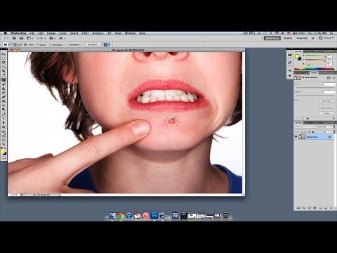 How to Get Rid of Acne | Photoshop Lessons