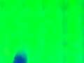videos de mulerosis elektrosonik