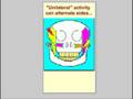 Definition of Bruxism