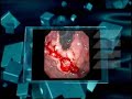 La Evolución de la Endoscopia La Evolución de la Endoscopia