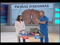 Doctor Tv explica porqué los pies y las piernas se hinchan