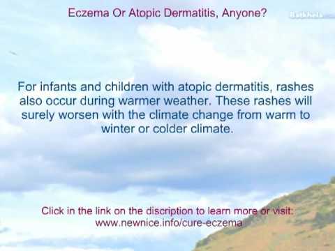 how to cure atopic dermatitis