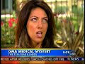 Brooke Landau Battle with Lyme Disease story on GMA