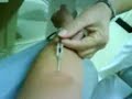 Doando sangue Doando sangue