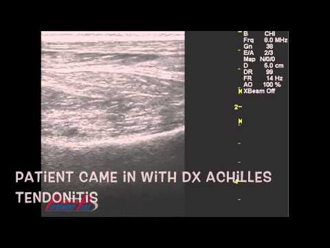 how to read ultrasound