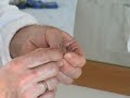 How To Fit A Snore-no-More Nasal Dilator How To Fit A Snore-no-More Nasal Dilator