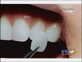 Dubai Best Cosmetic Dentist