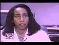 Tummy Tuck, Plastic / Cosmetic Surgery Dr. Hardaway
