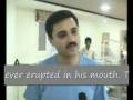 Implants & Dental Crowns In an Hour ( English Sub Headings)