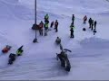 Scooter Accident