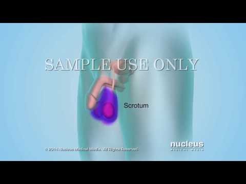 how to check quality of sperm