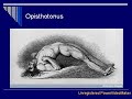 Tetanus-P.Polzin5