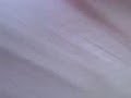 rodo