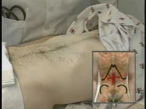 Abdominal Exam - Examen de l.Abdomen ...