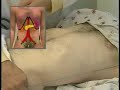 Abdominal Exam - Examen de l.Abdomen part2/2