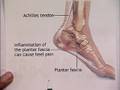 videos de IPMA 'Feet Forward' - Kids Feet Health One -- Part 3