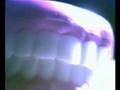videos de zęby.mpg