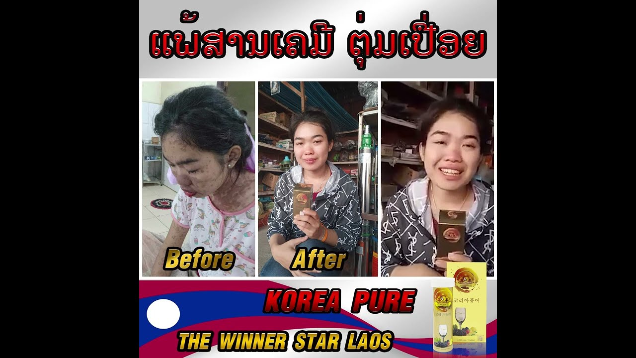 Korea Pure Review By ນາງໜີງ
