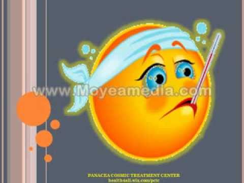 how to cure viral fever
