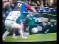 lesion de messi