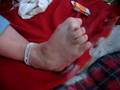 Anna's Weird Foot