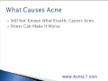 Best Way To Get Rid of Acne