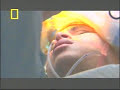 Impresionante Operaci�n de Cerebro