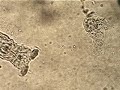 Rotifer and amoeba