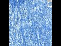 Shotgun Histology Fibro-Cartilage