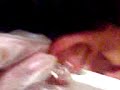 poniendo un piercing en el cuajo de la oreja!