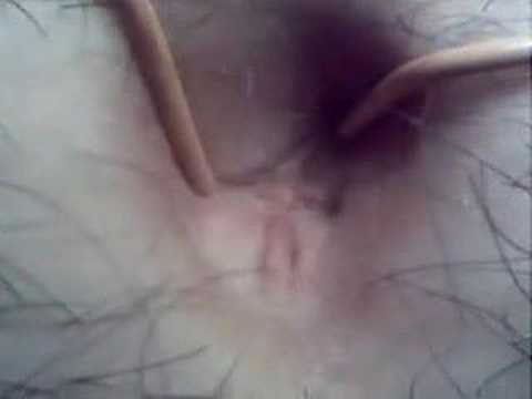 فيديو غشاء البكارة بالصور - Nothing inside my belly button is safe from your view in this stretching video!