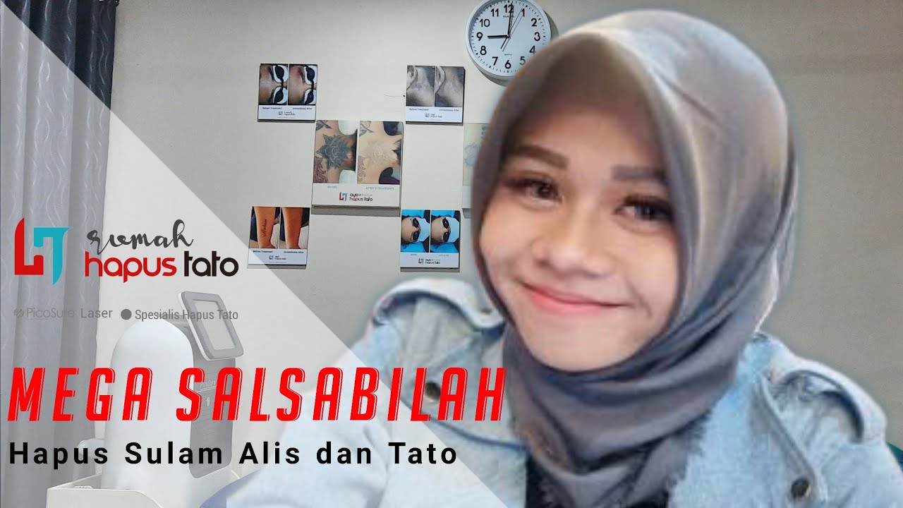 Mega Salsabilah Suca 4 Hapus Tato - Rumah Hapus Tato