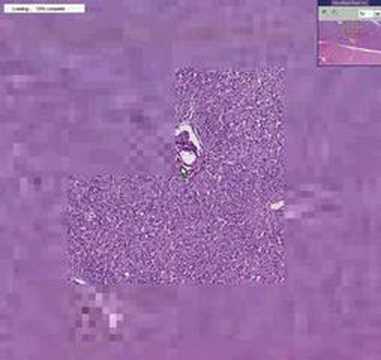 Histopathology Heart, ...