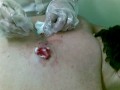 a cirurgia parte 3.mp4