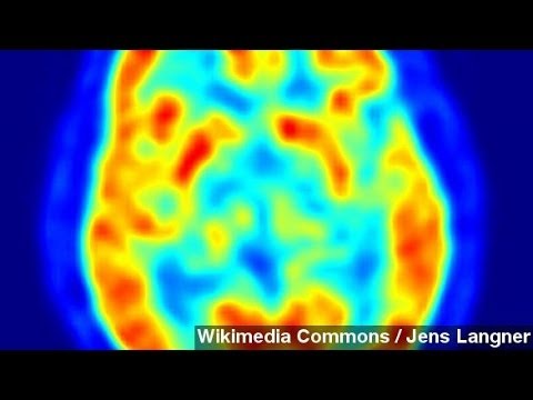 how to discover switch