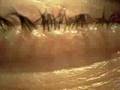LASIK Video LASIK Video