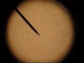 Sperm under microscope Sperm under microscope