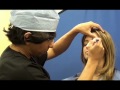 Eyelid Surgery - Eyelift - Before & After (Amiya Prasad MD)