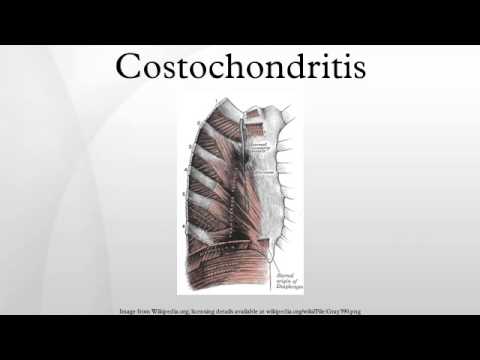 how to treat tietze syndrome