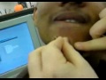 Popping-a-big-ass-pimple.mp4