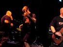 Sarcoma 7/6/07