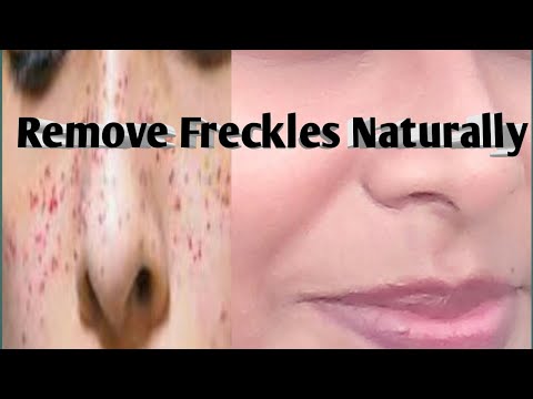 video-linktoworks-How To Get Rid Of Freckles On Face Naturally In Hindi...