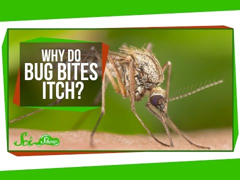 Why Do Bug Bites Itch?
