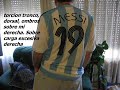 Un caso de Ictus - Stroke - ACV y secuelas